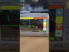 Erfahren Sie, warum Sie sich für den LCD-Bildschirm des Mindray BeneView T1-Patientenmonitors mit Frontabdeckung entscheiden sollten