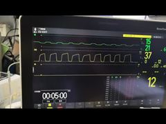Sehen Sie sich die Demo des Mindray AG-Moduls AG und des O2-Moduls MMS-Modul PN 115-023943-00 an